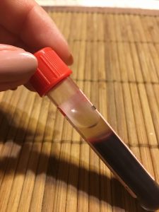 vial of blood blood test